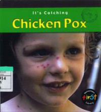 Chicken Pox