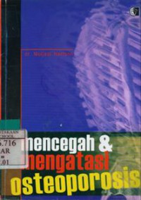 Mencegah & Mengatasi Osteoporosis